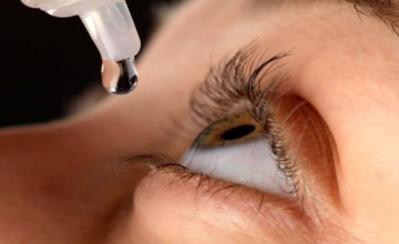 Dry Eye Treatment