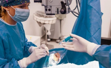 Keratoplasty Surgery