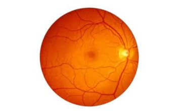 Retina and Uvea